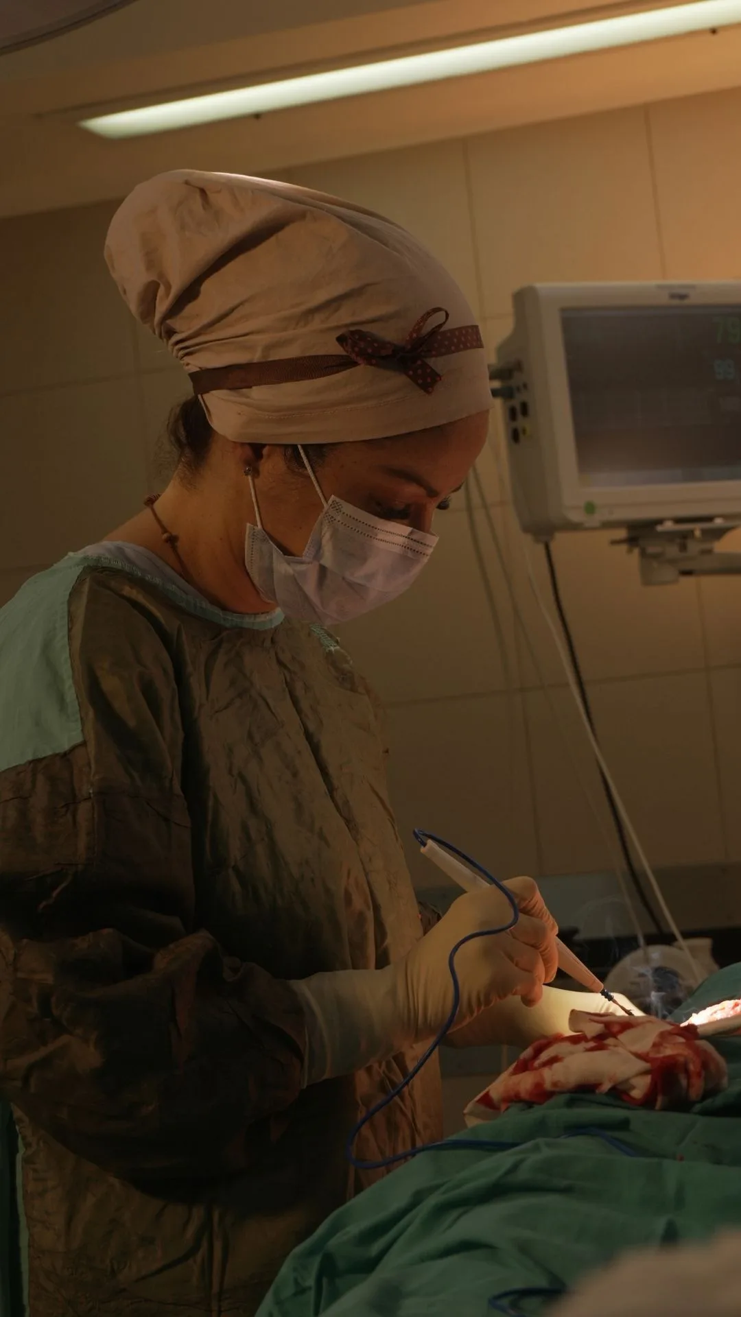 Lip Lift Buenos Aires · Dra. Jenny Ortega De La Rosa